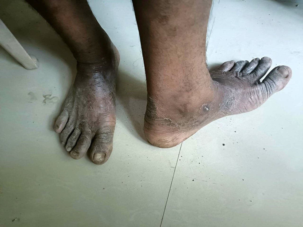 2023 06 Well Digging Case Survivor Feet 3 jpeg 202306 MUM Well Digging Rescue Approved for Full Use